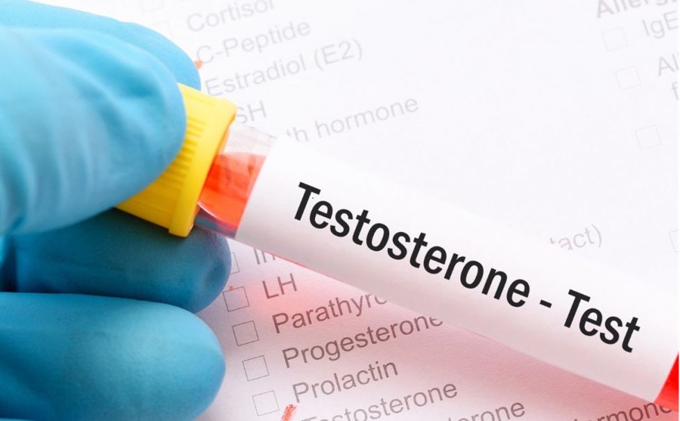 test na testosteron